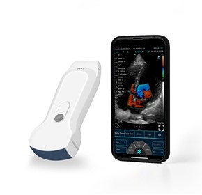 Handheld Ultrasound Machine