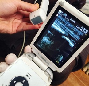 Expanding access to health care in Papua New Guinea with handheld ultrasound