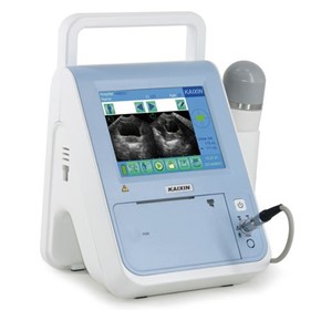 Bladder Scanner